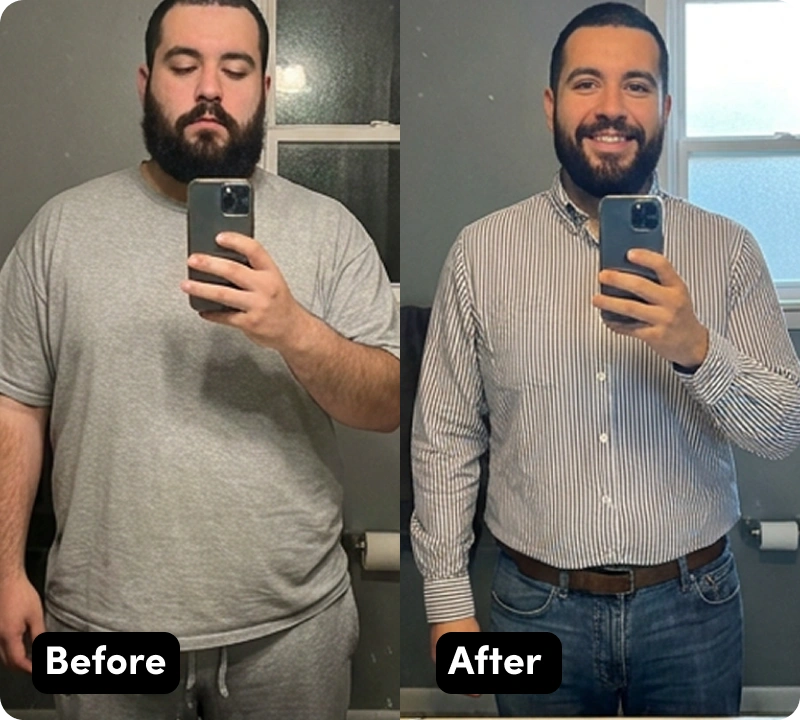 Javier before and after